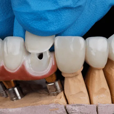 Dentista cerca de Mall El Jardín, Quito, Ecuador