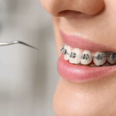 Dentista cerca de Scala Shopping, Quito, Ecuador