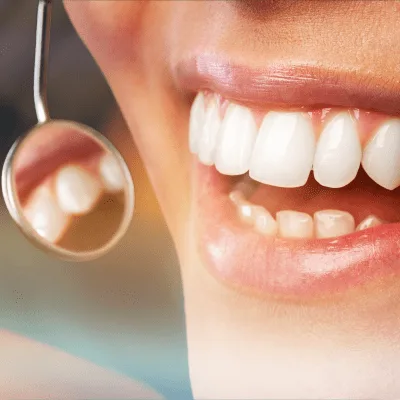 Dentista cerca de Supercines Quicentro, Quito, Ecuador
