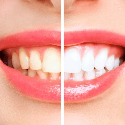 Dentista con seguro de gastos médicos mayores en Quito