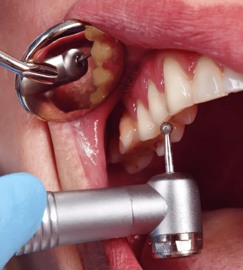 Dolor al masticar: Guía de síntomas y atención profesional en Quito